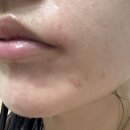 봄메디 | 메디테라피 토타롤 내돈내산 후기 + 판테놀 크림까지 한 달 써봄