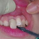 거성치과기공소 이미지