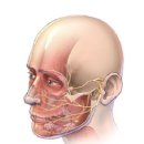 Facial Nerve Paralysis 이미지