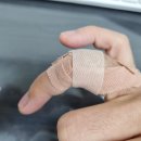 일상:) 스쳐면 인연이라 하는데 스치면 너무 아파요 &#39;손가락 석회 건염&#39;
