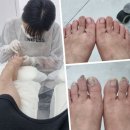 레푸스 | 인천 부평역 &#39;레푸스&#39; - 무좀스케일링 후기