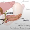 간내담관암&#39; 어떻게 대처해야 하나요? 이미지