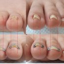 페디베네 이미지