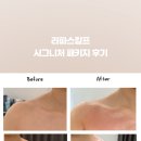 라파힐링피부관리
