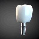 항재식당 | 세종임플란트치과 정말 10년 이상 사용할까? -솔직고백