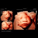 한빛병원 | [임신 27주/7개월 차] 안산 한빛여성병원 입체 초음파 후기