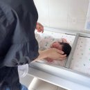 다나의원 | [대구 1차 영유아 검진] 다나소아청소년과 BCG피내용 접종 후기 (feat. 설소대 수술?)