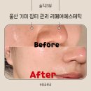 리페어에스테틱 | 울산 기미 잡티 관리 리페어에스테틱 만족한 후기