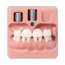 정수치과의원 | 드디어 고민 끝! 내 치아 인생 레벨업 가보자고~