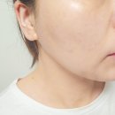 (주)케어텍 | 집에서 쓰는 에스테틱 화장품 레테르니타 고함량 비타민C 사용후기