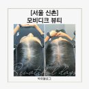 신촌 | 신촌smp 후기✨엄마 정수리 두피문신 1회차 기록