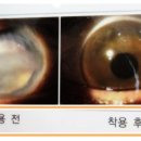 홍채안경원 이미지