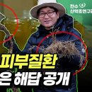 지긋지긋한 피부질환 산에서 찾은 해답 공개 - 고삼, 백선피 이미지