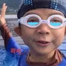 지음메디케어 | [성형] 윗트임+절개쌍수: 쌍커풀수술 준비물 쌍수꿀템 추천