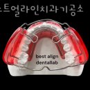 가산디지털치과기공소 이미지