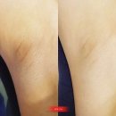 유노이아 이미지