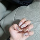 풋솔루션 이미지