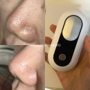 비베 | 피지제거기 추천 코 피지흡입기 블랙헤드 온열 피지압출기 흡착기 바비베 사용후기