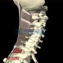 목, 어깨, 머리, 등 총증 - 서울믿음재활의학과 근골격계 통증센터 이미지