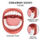 김대영치과의원 | 은계지구치과, 사랑니 발치 후기보다 이 글이 더 도움 될 겁니다