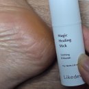 자운고등학교 | 식물성 바세린 가려움증 피부보습 자운고 멀티밤 사용후기