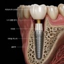 지산행복을 심는 치과의원 | 강남역 임플란트 믿을수있는 치과의 기준은 뭘까요?