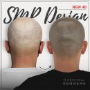 마음에점을찍다제주점 | 광주두피문신 마음에점을찍다 후기, 자연스러운 변화