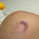 제너레이션 | [2025] '더 제너레이션 매치' 직관 후기 ⚾️