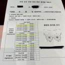 분당유외과에서 맘모톰 후기(feat.멍, 혈종없이 회복하는 꿀팁)