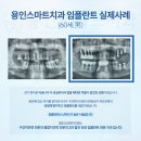 이플랜치과의원 이미지