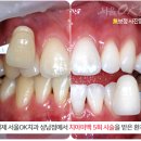 미백세탁 이미지