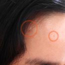 대웅돈 유전자 | 상처와 피부 재생 효과의 대웅제약 이지에프새살연고 추천