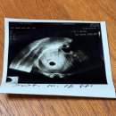 한마음산부인과의원 | [임신5주차] 5주차 초음파와 임신확인서, 창원 산부인과 추천-창원 센텀산부인과