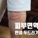 한국한센복지협회경기인천지부부설의원 | 만성두드러기 3번째 발생; 만성 두드러기 없애는 방법