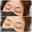 4776 | 대구 중구 동성로 눈썹문신/ 자연스러운 디자인과 깔끔하게