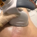 에디뷰티 | 창원 에디뷰티 제이루리 등관리 후기 척추 교정과 라운드 숄더 심각한 분들 위한 웨딩 준비 추천