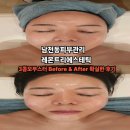 레몬트리 | 남천동피부관리 3콤보부스터 받고 대 만족한 후기 레몬트리에스테틱