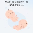 대전우리병원 | 대전 충남대병원 제왕절개 후기 - 수술 당일, 1인실 추천