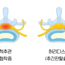 해빛1로 이미지