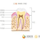 승치과의원 티스토리