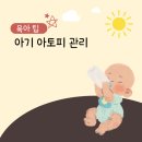 아기 아토피 초기 증상 확인과 시기별 관리 방법