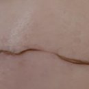 시티플래닝 | 원주 무실동 피부관리 이뉴뷰티 스킨플래닝 관리 후기