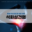 안동제통마취통증의학과의원 | 안동 어깨 통증, 팔을 못 들 정도로 아픈 어깨… &#39;석회성건염&#39; 의심해보세요
