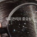 헤어나다 | 여름철 두피 관리법 & 시원한 두피 케어 제품 추천!
