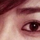 코코성형외과/메부리코성형 코수술후기 부끄럽지만 사진투척~^^