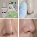 케어플러스 | 블랙헤드 제거 메디필 피지클리너 케어플러스 코팩 다이소 모공브러쉬 내돈내산 효과 후기