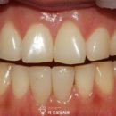 수자인치과의원 네이버블로그