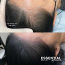 파주시야당보건진료소 | 파주 운정·야당 탈모 고민, SMP로 달라집니다