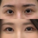 강남-164 이미지