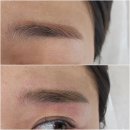 [구월동 눈썹] 미몽메이크| 잔흔제거| 솔직후기